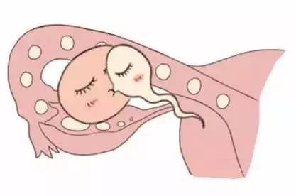 专业孕妈供卵助孕包生儿子